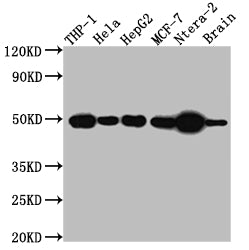 Western Blot; Positive WB detected in: THP-1 whole cell lysate, Hela whole cell lysate, HepG2 whole cell lysate, MCF-7 whole cell lysate, Ntera-2 whole cell lysate, Mouse Brain whole cell lysate; All lanes: TACR1 antibody at 1:1000; Secondary; Goat polyclonal to rabbit IgG at 1/50000 dilution; Predicted band size: 47, 36 kDa; Observed band size: 50 kDa