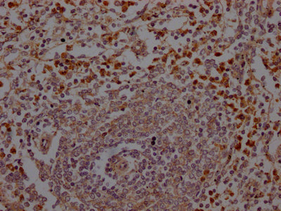 IHC image of RAC07545 diluted at 1:100 and staining in paraffin-embedded human spleen tissue performed on a Leica BondTM system. After dewaxing and hydration, antigen retrieval was mediated by high pressure in a citrate buffer (pH 6.0). Section was blocked with 10% normal goat serum 30min at RT. Then primary antibody (1% BSA) was incubated at 4? overnight. The primary is detected by a Goat anti-rabbit IgG polymer labeled by HRP and visualized using 0.05% DAB.