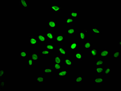 Immunofluorescence staining of Hela Cells with RAC07547 at 1:50, counter-stained with DAPI. The cells were fixed in 4% formaldehyde, permeated by 0.2% TritonX-100, and blocked in 10% normal Goat Serum. The cells were then incubated with the antibody overnight at 4?. Nuclear DNA was labeled in blue with DAPI. The secondary antibody was FITC-conjugated AffiniPure Goat Anti-Rabbit IgG (H+L).