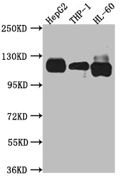 Western Blot; Positive WB detected in: HepG2 whole cell lysate, THP-1 whole cell lysate, HL-60 whole cell lysate; All lanes: Notch1 antibody at 1:1000; Secondary; Goat polyclonal to rabbit IgG at 1/50000 dilution; Predicted band size: 273 kDa; Observed band size: 120 kDa