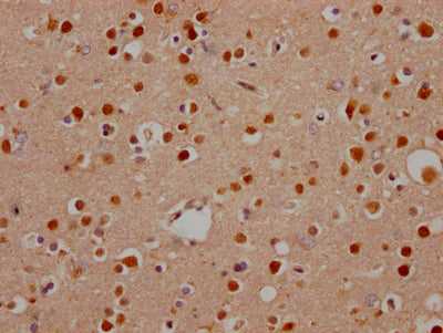 IHC image of RAC07548 diluted at 1:100 and staining in paraffin-embedded human brain tissue performed on a Leica BondTM system. After dewaxing and hydration, antigen retrieval was mediated by high pressure in a citrate buffer (pH 6.0). Section was blocked with 10% normal goat serum 30min at RT. Then primary antibody (1% BSA) was incubated at 4? overnight. The primary is detected by a Goat anti-rabbit IgG polymer labeled by HRP and visualized using 0.05% DAB.