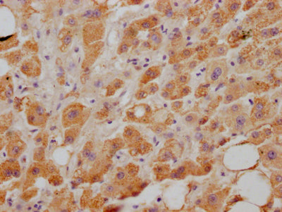 IHC image of RAC07549 diluted at 1:100 and staining in paraffin-embedded human liver tissue performed on a Leica BondTM system. After dewaxing and hydration, antigen retrieval was mediated by high pressure in a citrate buffer (pH 6.0). Section was blocked with 10% normal goat serum 30min at RT. Then primary antibody (1% BSA) was incubated at 4? overnight. The primary is detected by a Goat anti-rabbit IgG polymer labeled by HRP and visualized using 0.05% DAB.