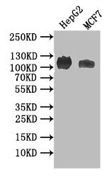 Western Blot; Positive WB detected in: HEPG2 whole cell lysate, MCF7 whole cell lysate; All lanes: ANPRB antibody at 1:1000; Secondary; Goat polyclonal to rabbit IgG at 1/50000 dilution; Predicted band size: 117 kDa; Observed band size: 117 kDa