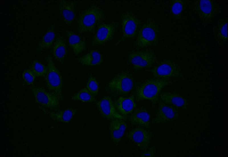 Immunofluorescence staining of Hela with RAC07551 at 1:25, counter-stained with DAPI. The cells were fixed in 4% formaldehyde and blocked in 10% normal Goat Serum. The cells were then incubated with the antibody overnight at 4Â°C. The secondary antibody was Alexa Fluor 501-congugated AffiniPure Goat Anti-Rabbit IgG(H+L).