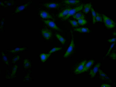 Immunofluorescence staining of Hela Cells with RAC07553 at 1:50, counter-stained with DAPI. The cells were fixed in 4% formaldehyde, permeated by 0.2% TritonX-100, and blocked in 10% normal Goat Serum. The cells were then incubated with the antibody overnight at 4?. Nuclear DNA was labeled in blue with DAPI. The secondary antibody was FITC-conjugated AffiniPure Goat Anti-Rabbit IgG (H+L).