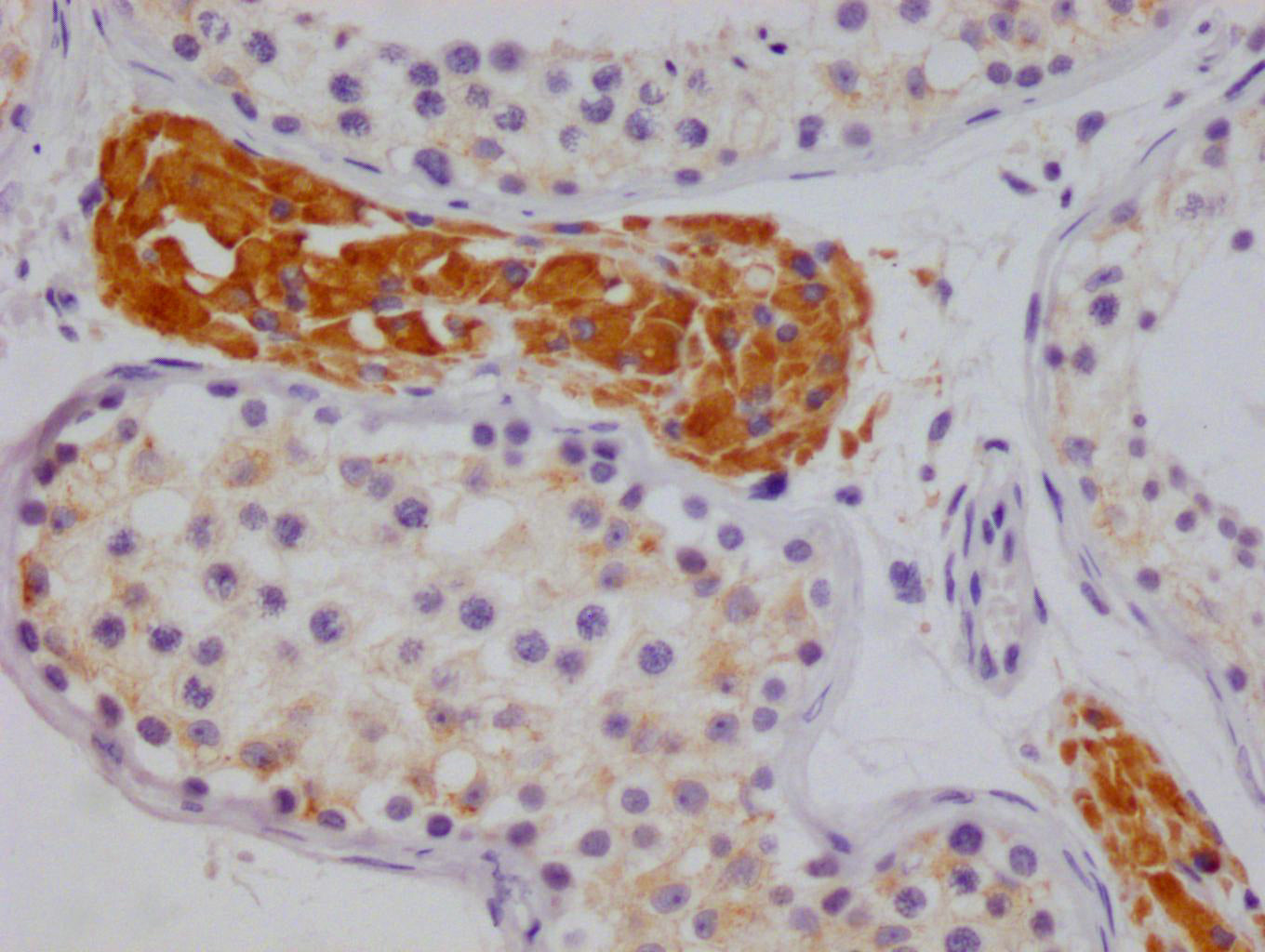 IHC image of RAC07554 diluted at 1:100 and staining in paraffin-embedded human testis tissue performed on a Leica BondTM system. After dewaxing and hydration, antigen retrieval was mediated by high pressure in a citrate buffer (pH 6.0). Section was blocked with 10% normal goat serum 30min at RT. Then primary antibody (1% BSA) was incubated at 4Â°C overnight. The primary is detected by a Goat anti-rabbit polymer IgG labeled by HRP and visualized using 0.05% DAB.