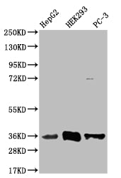 Western Blot; Positive WB detected in: HepG2 whole cell lysate, HEK293 whole cell lysate, PC-3 whole cell lysate; All lanes: NTHL1 antibody at 1:1000; Secondary; Goat polyclonal to rabbit IgG at 1/50000 dilution; Predicted band size: 35, 34, 33 kDa; Observed band size: 35 kDa