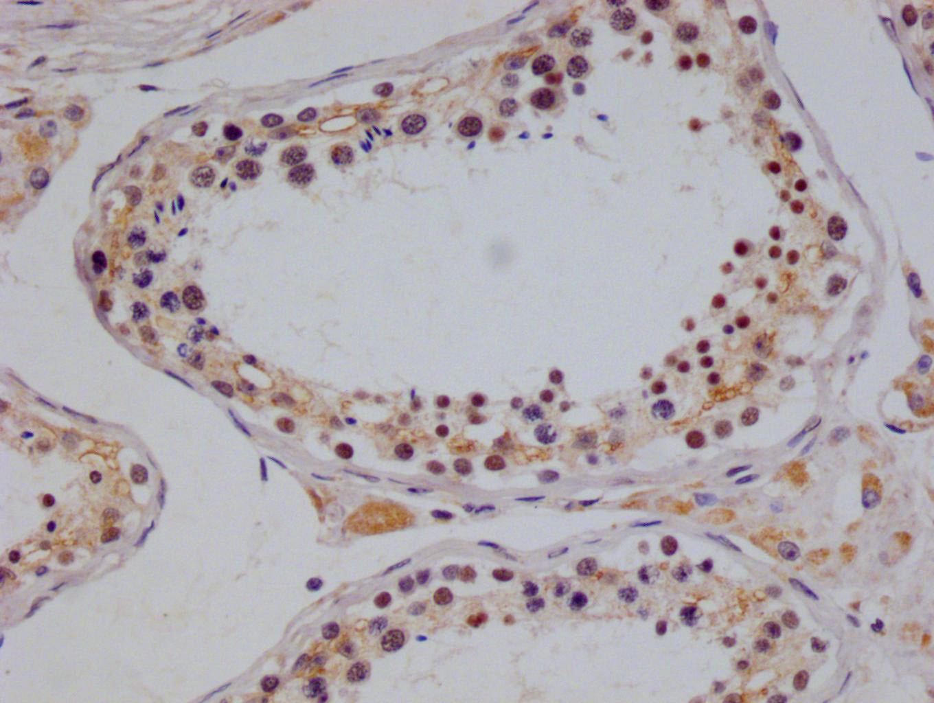 IHC image of RAC07555 diluted at 1:100 and staining in paraffin-embedded human testis tissue performed on a Leica BondTM system. After dewaxing and hydration, antigen retrieval was mediated by high pressure in a citrate buffer (pH 6.0). Section was blocked with 10% normal goat serum 30min at RT. Then primary antibody (1% BSA) was incubated at 4Â°C overnight. The primary is detected by a Goat anti-rabbit polymer IgG labeled by HRP and visualized using 0.05% DAB.