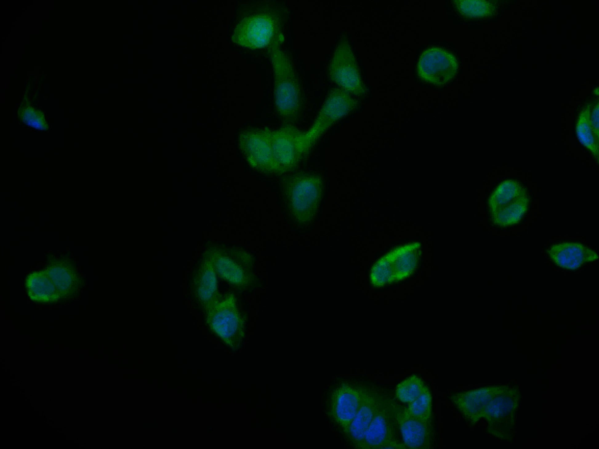 Immunofluorescence staining of PC-3 cell with RAC07555 at 1:50, counter-stained with DAPI. The cells were fixed in 4% formaldehyde and blocked in 10% normal Goat Serum. The cells were then incubated with the antibody overnight at 4Â°C. The secondary antibody was Alexa Fluor 604-congugated AffiniPure Goat Anti-Rabbit IgG(H+L).