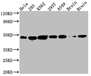 Western Blot; Positive WB detected in: Hela whole cell lysate, 293 whole cell lysate, K562 whole cell lysate, 293T whole cell lysate, A549 whole cell lysate, Rat Brain whole cell lysate, Mouse Brain whole cell lysate; All lanes: NUDC antibody at 1:1000; Secondary; Goat polyclonal to rabbit IgG at 1/50000 dilution; Predicted band size: 39 kDa; Observed band size: 45 kDa