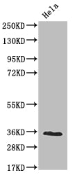Western Blot; Positive WB detected in: Hela whole cell lysate; All lanes: NUDT5 antibody at 1:2000; Secondary; Goat polyclonal to rabbit IgG at 1/50000 dilution; Predicted band size: 25 kDa; Observed band size: 36 kDa