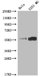Western Blot; Positive WB detected in: Hela whole cell lysate, U251 whole cell lysate; All lanes: NUF2 antibody at 1:2000; Secondary; Goat polyclonal to rabbit IgG at 1/50000 dilution; Predicted band size: 55 kDa; Observed band size: 55 kDa