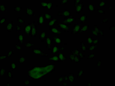 Immunofluorescence staining of Hela Cells with RAC07560 at 1:50, counter-stained with DAPI. The cells were fixed in 4% formaldehyde, permeated by 0.2% TritonX-100, and blocked in 10% normal Goat Serum. The cells were then incubated with the antibody overnight at 4?. Nuclear DNA was labeled in blue with DAPI. The secondary antibody was FITC-conjugated AffiniPure Goat Anti-Rabbit IgG (H+L).