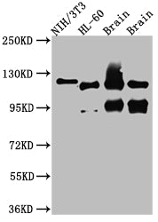 Western Blot; Positive WB detected in: NIH/3T3 whole cell lysate, HL-60 whole cell lysate, Rat Brain whole cell lysate, Mouse Brain whole cell lysate; All lanes: OGT antibody at 1:1000; Secondary; Goat polyclonal to rabbit IgG at 1/50000 dilution; Predicted band size: 117, 104, 116, 75 kDa; Observed band size: 117 kDa