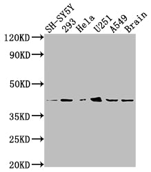 Western Blot; Positive WB detected in: SH-SY5Y whole cell lysate, 293 whole cell lysate, Hela whole cell lysate, U251 whole cell lysate, A549 whole cell lysate, Mouse brain tissue; All lanes: OPRD1 antibody at 1:2000; Secondary; Goat polyclonal to rabbit IgG at 1/50000 dilution; Predicted band size: 41 kDa; Observed band size: 41 kDa