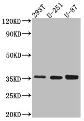 Western Blot; Positive WB detected in: 293T whole cell lysate, U-251 whole cell lysate, U-87 whole cell lysate; All lanes: Osteopontin Antibody at 1:1000; Secondary; Goat polyclonal to rabbit IgG at 1/50000 dilution; Predicted band size: 36, 34, 33, 34, 34 kDa; Observed band size: 36 kDa
