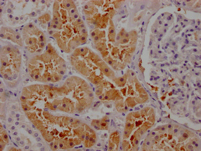 IHC image of RAC07565 diluted at 1:100 and staining in paraffin-embedded human kidney tissue performed on a Leica BondTM system. After dewaxing and hydration, antigen retrieval was mediated by high pressure in a citrate buffer (pH 6.0). Section was blocked with 10% normal goat serum 30min at RT. Then primary antibody (1% BSA) was incubated at 4? overnight. The primary is detected by a Goat anti-rabbit IgG polymer labeled by HRP and visualized using 0.05% DAB.