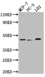 Western Blot; Positive WB detected in: MCF-7 whole cell lysate, PC-3 whole cell lysate, L02 whole cell lysate; All lanes: p38 antibody at 1:1000; Secondary; Goat polyclonal to rabbit IgG at 1/50000 dilution; Predicted band size: 42, 42, 35, 36 kDa; Observed band size: 42 kDa