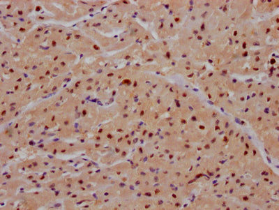 IHC image of RAC07566 diluted at 1:100 and staining in paraffin-embedded human heart tissue performed on a Leica BondTM system. After dewaxing and hydration, antigen retrieval was mediated by high pressure in a citrate buffer (pH 6.0). Section was blocked with 10% normal goat serum 30min at RT. Then primary antibody (1% BSA) was incubated at 4? overnight. The primary is detected by a Goat anti-rabbit IgG polymer labeled by HRP and visualized using 0.05% DAB.