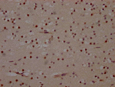 IHC image of RAC07566 diluted at 1:100 and staining in paraffin-embedded human brain tissue performed on a Leica BondTM system. After dewaxing and hydration, antigen retrieval was mediated by high pressure in a citrate buffer (pH 6.0). Section was blocked with 10% normal goat serum 30min at RT. Then primary antibody (1% BSA) was incubated at 4? overnight. The primary is detected by a Goat anti-rabbit IgG polymer labeled by HRP and visualized using 0.05% DAB.
