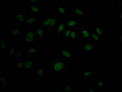 Immunofluorescence staining of Hela Cells with RAC07566 at 1:50, counter-stained with DAPI. The cells were fixed in 4% formaldehyde, permeated by 0.2% TritonX-100, and blocked in 10% normal Goat Serum. The cells were then incubated with the antibody overnight at 4?. Nuclear DNA was labeled in blue with DAPI. The secondary antibody was FITC-conjugated AffiniPure Goat Anti-Rabbit IgG (H+L).