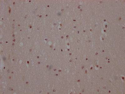 IHC image of RAC07568 diluted at 1:100 and staining in paraffin-embedded human brain tissue performed on a Leica BondTM system. After dewaxing and hydration, antigen retrieval was mediated by high pressure in a citrate buffer (pH 6.0). Section was blocked with 10% normal goat serum 30min at RT. Then primary antibody (1% BSA) was incubated at 4? overnight. The primary is detected by a Goat anti-rabbit IgG polymer labeled by HRP and visualized using 0.05% DAB.