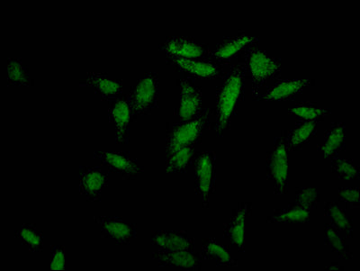 Immunofluorescence staining of Hela Cells with RAC07568 at 1:50, counter-stained with DAPI. The cells were fixed in 4% formaldehyde, permeated by 0.2% TritonX-100, and blocked in 10% normal Goat Serum. The cells were then incubated with the antibody overnight at 4?. Nuclear DNA was labeled in blue with DAPI. The secondary antibody was FITC-conjugated AffiniPure Goat Anti-Rabbit IgG (H+L).