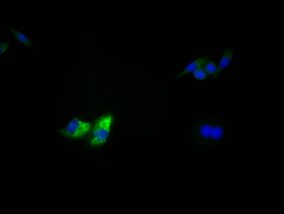 Immunofluorescence staining of HepG2 Cells with RAC07569 at 1:50, counter-stained with DAPI. The cells were fixed in 4% formaldehyde, permeated by 0.2% TritonX-100, and blocked in 10% normal Goat Serum. The cells were then incubated with the antibody overnight at 4?. Nuclear DNA was labeled in blue with DAPI. The secondary antibody was FITC-conjugated AffiniPure Goat Anti-Rabbit IgG (H+L).