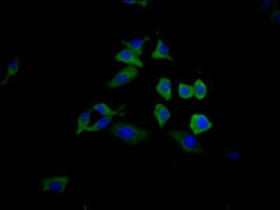 Immunofluorescence staining of HepG2 Cells with RAC07570 at 1:50, counter-stained with DAPI. The cells were fixed in 4% formaldehyde, permeated by 0.2% TritonX-100, and blocked in 10% normal Goat Serum. The cells were then incubated with the antibody overnight at 4?. Nuclear DNA was labeled in blue with DAPI. The secondary antibody was FITC-conjugated AffiniPure Goat Anti-Rabbit IgG (H+L).