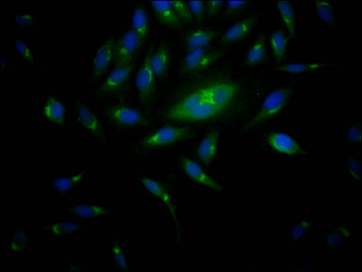 Immunofluorescence staining of Hela Cells with RAC07572 at 1:50, counter-stained with DAPI. The cells were fixed in 4% formaldehyde, permeated by 0.2% TritonX-100, and blocked in 10% normal Goat Serum. The cells were then incubated with the antibody overnight at 4?. Nuclear DNA was labeled in blue with DAPI. The secondary antibody was FITC-conjugated AffiniPure Goat Anti-Rabbit IgG (H+L).