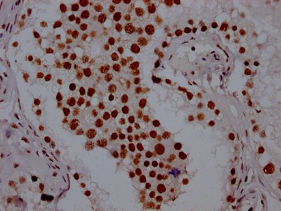 IHC image of RAC07573 diluted at 1:100 and staining in paraffin-embedded human testis tissue performed on a Leica BondTM system. After dewaxing and hydration, antigen retrieval was mediated by high pressure in a citrate buffer (pH 6.0). Section was blocked with 10% normal goat serum 30min at RT. Then primary antibody (1% BSA) was incubated at 4? overnight. The primary is detected by a Goat anti-rabbit IgG polymer labeled by HRP and visualized using 0.05% DAB.
