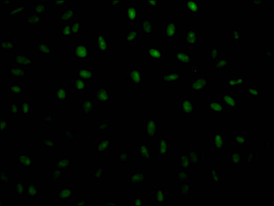Immunofluorescence staining of Hela Cells with RAC07573 at 1:50, counter-stained with DAPI. The cells were fixed in 4% formaldehyde, permeated by 0.2% TritonX-100, and blocked in 10% normal Goat Serum. The cells were then incubated with the antibody overnight at 4?. Nuclear DNA was labeled in blue with DAPI. The secondary antibody was FITC-conjugated AffiniPure Goat Anti-Rabbit IgG (H+L).