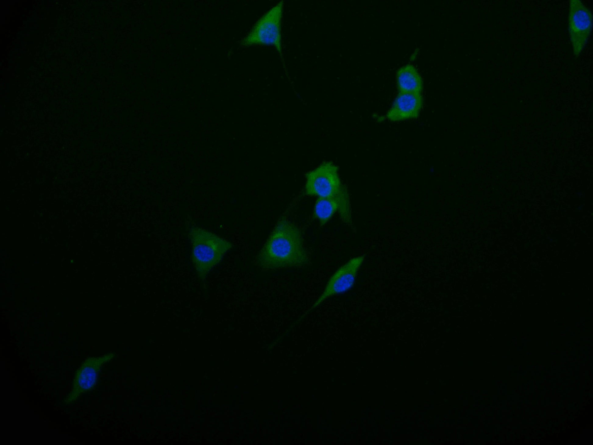 Immunofluorescence staining of MCF-7 cell with RAC07574 at 1:50, counter-stained with DAPI. The cells were fixed in 4% formaldehyde and blocked in 10% normal Goat Serum. The cells were then incubated with the antibody overnight at 4Â°C. The secondary antibody was Alexa Fluor 598-congugated AffiniPure Goat Anti-Rabbit IgG(H+L).