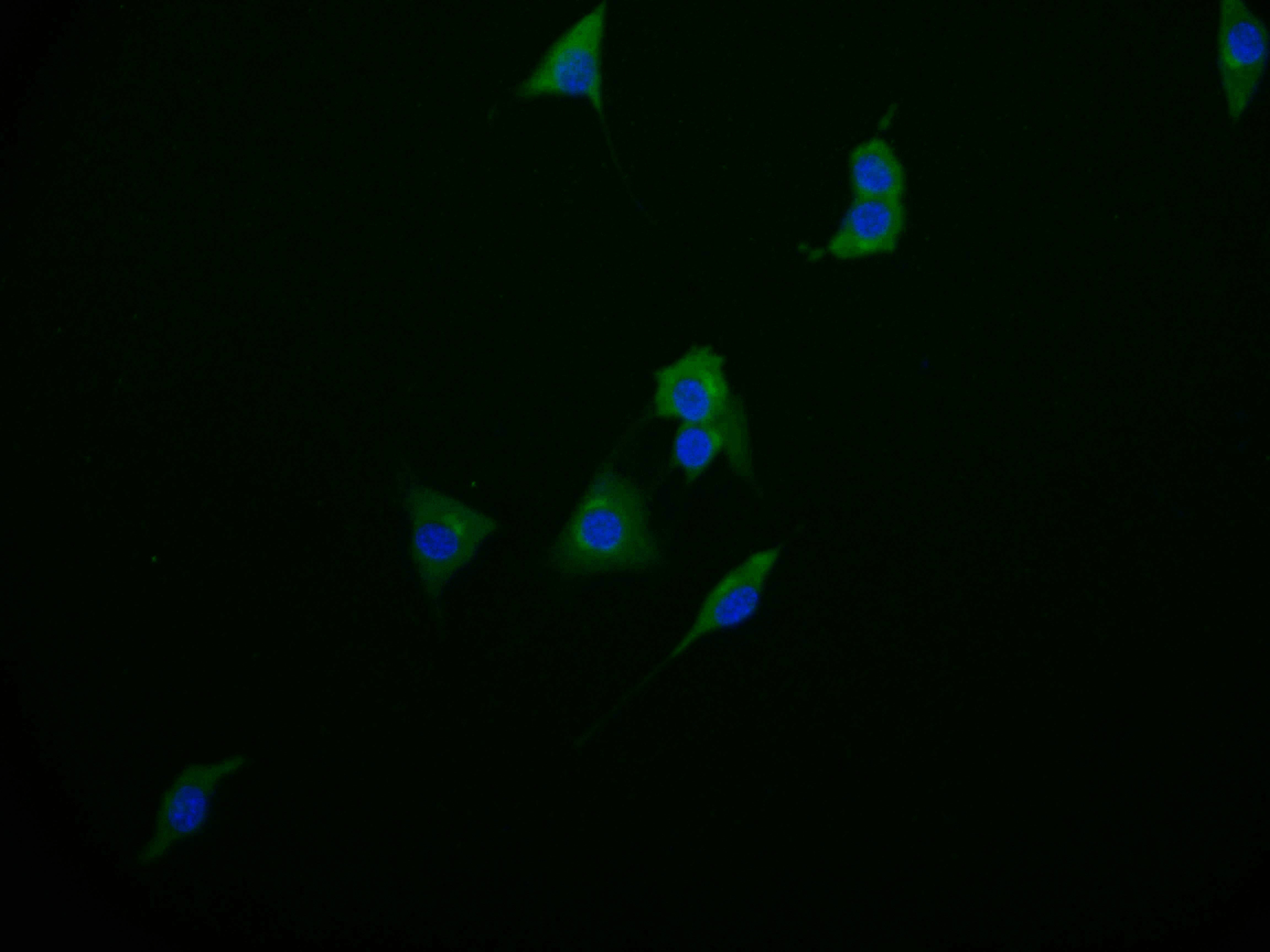 Immunofluorescence staining of MCF-7 cell with RAC07574 at 1:50, counter-stained with DAPI. The cells were fixed in 4% formaldehyde and blocked in 10% normal Goat Serum. The cells were then incubated with the antibody overnight at 4Â°C. The secondary antibody was Alexa Fluor 598-congugated AffiniPure Goat Anti-Rabbit IgG(H+L).