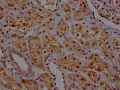 IHC image of RAC07575 diluted at 1:100 and staining in paraffin-embedded human kidney tissue performed on a Leica BondTM system. After dewaxing and hydration, antigen retrieval was mediated by high pressure in a citrate buffer (pH 6.0). Section was blocked with 10% normal goat serum 30min at RT. Then primary antibody (1% BSA) was incubated at 4? overnight. The primary is detected by a Goat anti-rabbit IgG polymer labeled by HRP and visualized using 0.05% DAB.