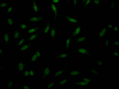 Immunofluorescence staining of Hela Cells with RAC07576 at 1:50, counter-stained with DAPI. The cells were fixed in 4% formaldehyde, permeated by 0.2% TritonX-100, and blocked in 10% normal Goat Serum. The cells were then incubated with the antibody overnight at 4?. Nuclear DNA was labeled in blue with DAPI. The secondary antibody was FITC-conjugated AffiniPure Goat Anti-Rabbit IgG (H+L).