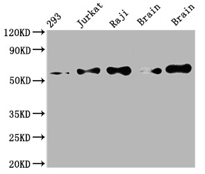 Western Blot; Positive WB detected in: 293 whole cell lysate, Jurkat whole cell lysate, Raji whole cell lysate, Mouse brain tissue, Rat brain tissue; All lanes: PAK2 antibody at 1:2000; Secondary; Goat polyclonal to rabbit IgG at 1/50000 dilution; Predicted band size: 59 kDa; Observed band size: 59 kDa