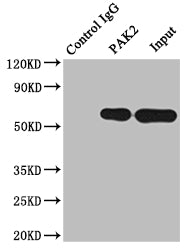 Immunoprecipitating PAK2 in Raji whole cell lysate; Lane 1: Rabbit control IgG instead of RAC07577 in Raji whole cell lysate.For western blotting,a HRP-conjugated Protein G antibody was used as the secondary antibody (1/2000); Lane 2: RAC07577(2ug)+ Raji whole cell lysate(500ug); Lane 3: Raji whole cell lysate (10ug)
