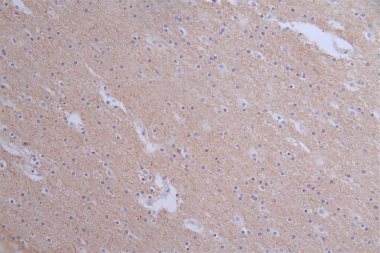 IHC image of RAC07578 diluted at 1:50 and staining in paraffin-embedded human brain tissue performed on a Leica BondTM system. After dewaxing and hydration, antigen retrieval was mediated by high pressure in a citrate buffer (pH 6.0). Section was blocked with 10% normal goat serum 30min at RT. Then primary antibody (1% BSA) was incubated at 4Â°C overnight. The primary is detected by a Goat anti-rabbit polymer IgG labeled by HRP and visualized using 0.1:50% DAB.