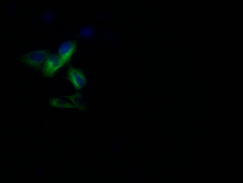 Immunofluorescence staining of U251 with RAC07578 at 1:10, counter-stained with DAPI. The cells were fixed in 4% formaldehyde and blocked in 10% normal Goat Serum. The cells were then incubated with the antibody overnight at 4Â°C. The secondary antibody was Alexa Fluor 502-congugated AffiniPure Goat Anti-Rabbit IgG(H+L).