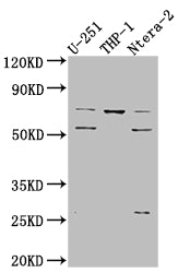 Western Blot; Positive WB detected in: U-251 whole cell lysate, THP-1 whole cell lysate, Ntera-2 whole cell lysate; All lanes: PTH1R antibody at 1:1000; Secondary; Goat polyclonal to rabbit IgG at 1/50000 dilution; Predicted band size: 67 kDa; Observed band size: 72, 55 kDa