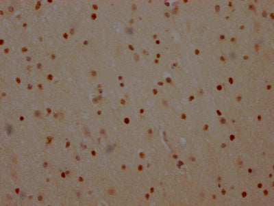 IHC image of RAC07581 diluted at 1:100 and staining in paraffin-embedded human brain tissue performed on a Leica BondTM system. After dewaxing and hydration, antigen retrieval was mediated by high pressure in a citrate buffer (pH 6.0). Section was blocked with 10% normal goat serum 30min at RT. Then primary antibody (1% BSA) was incubated at 4? overnight. The primary is detected by a Goat anti-rabbit IgG polymer labeled by HRP and visualized using 0.05% DAB.