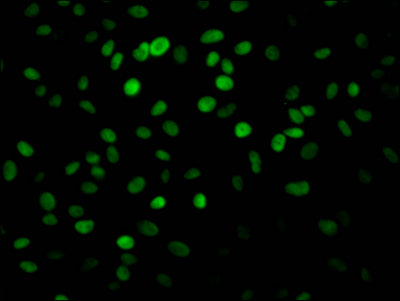 Immunofluorescence staining of Hela Cells with RAC07581 at 1:50, counter-stained with DAPI. The cells were fixed in 4% formaldehyde, permeated by 0.2% TritonX-100, and blocked in 10% normal Goat Serum. The cells were then incubated with the antibody overnight at 4?. Nuclear DNA was labeled in blue with DAPI. The secondary antibody was FITC-conjugated AffiniPure Goat Anti-Rabbit IgG (H+L).
