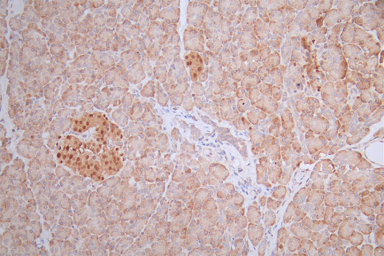 IHC image of RAC07582 diluted at 1:100 and staining in paraffin-embedded human pancreati tissue performed on a Leica BondTM system. After dewaxing and hydration, antigen retrieval was mediated by high pressure in a citrate buffer (pH 6.0). Section was blocked with 10% normal goat serum 30min at RT. Then primary antibody (1% BSA) was incubated at 4Â°C overnight. The primary is detected by a Goat anti-rabbit polymer IgG labeled by HRP and visualized using 0.55% DAB.