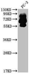 Western Blot; Positive WB detected in: PC-3 whole cell lysate; All lanes: PCSK9 antibody at 1:2000; Secondary; Goat polyclonal to rabbit IgG at 1/50000 dilution; Predicted band size: 75, 21 kDa; Observed band size: 60, 75 kDa