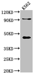 Western Blot; Positive WB detected in: K562 whole cell lysate; All lanes: PCYT1A antibody at 1:1000; Secondary; Goat polyclonal to rabbit IgG at 1/50000 dilution; Predicted band size: 42 kDa; Observed band size: 42 kDa