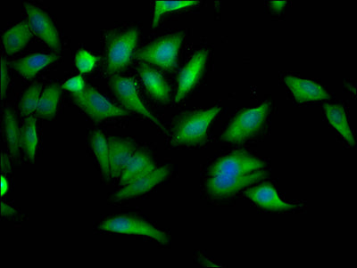 Immunofluorescence staining of Hela Cells with RAC07585 at 1:50, counter-stained with DAPI. The cells were fixed in 4% formaldehyde, permeated by 0.2% TritonX-100, and blocked in 10% normal Goat Serum. The cells were then incubated with the antibody overnight at 4?. Nuclear DNA was labeled in blue with DAPI. The secondary antibody was FITC-conjugated AffiniPure Goat Anti-Rabbit IgG (H+L).