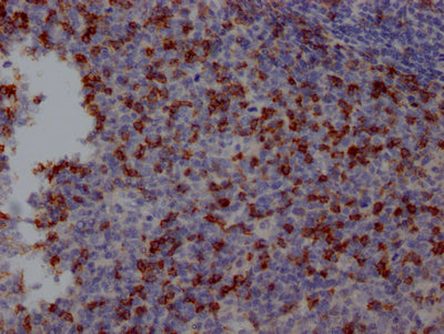 IHC image of RAC07586 diluted at 1:100 and staining in paraffin-embedded human tonsil tissue performed on a Leica BondTM system. After dewaxing and hydration, antigen retrieval was mediated by high pressure in a citrate buffer (pH 6.0). Section was blocked with 10% normal goat serum 30min at RT. Then primary antibody (1% BSA) was incubated at 4? overnight. The primary is detected by a Goat anti-rabbit IgG polymer labeled by HRP and visualized using 0.05% DAB.
