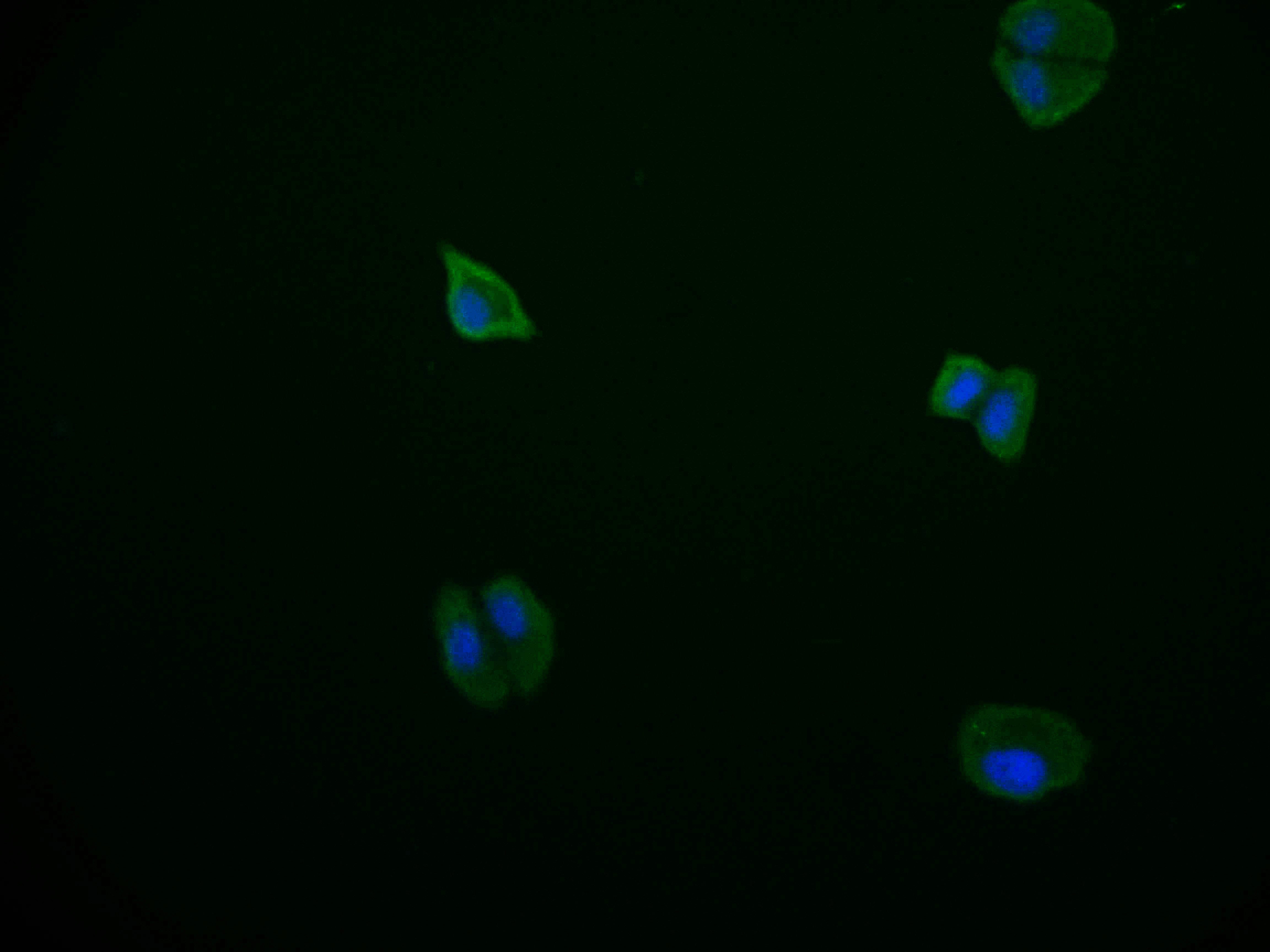 Immunofluorescence staining of HepG2 cell at 1:50, counter-stained with DAPI. The cells were fixed in 4% formaldehyde and blocked in 10% normal Goat Serum. The cells were then incubated with the antibody overnight at 4Â°C. The secondary antibody was Alexa Fluor 569-congugated AffiniPure Goat Anti-Rabbit IgG(H+L).