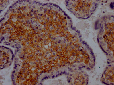 IHC image of RAC07589 diluted at 1:100 and staining in paraffin-embedded human placenta tissue performed on a Leica BondTM system. After dewaxing and hydration, antigen retrieval was mediated by high pressure in a citrate buffer (pH 6.0). Section was blocked with 10% normal goat serum 30min at RT. Then primary antibody (1% BSA) was incubated at 4? overnight. The primary is detected by a Goat anti-rabbit IgG polymer labeled by HRP and visualized using 0.05% DAB.